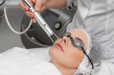Advantages of laser rejuvenation
